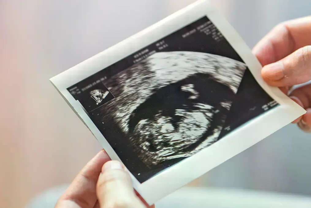 Englishman fined for quoting Psalm 139 near abortion facility plans appeal