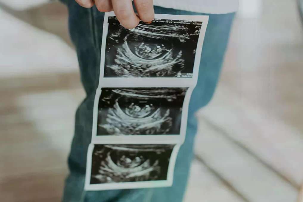 Sisters of Life recognize Archbishop Aquila’s fidelity to life