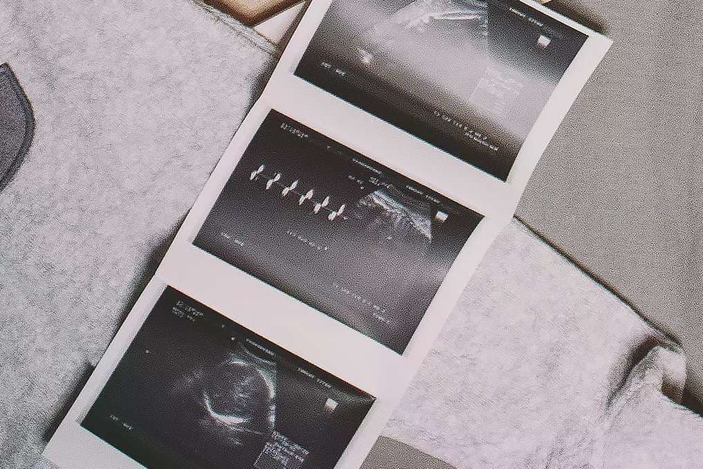 Pro-life law to blame? Doctors respond to report about pregnant mother who died without necessary medical care